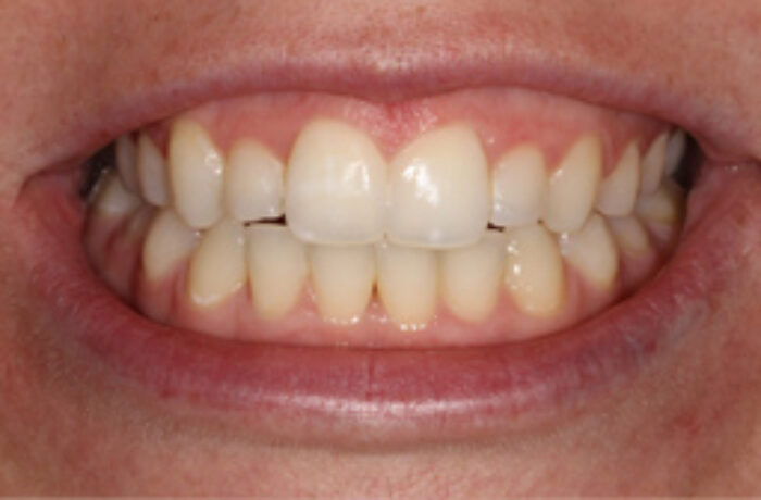 After - Cheadle Hulme Dental