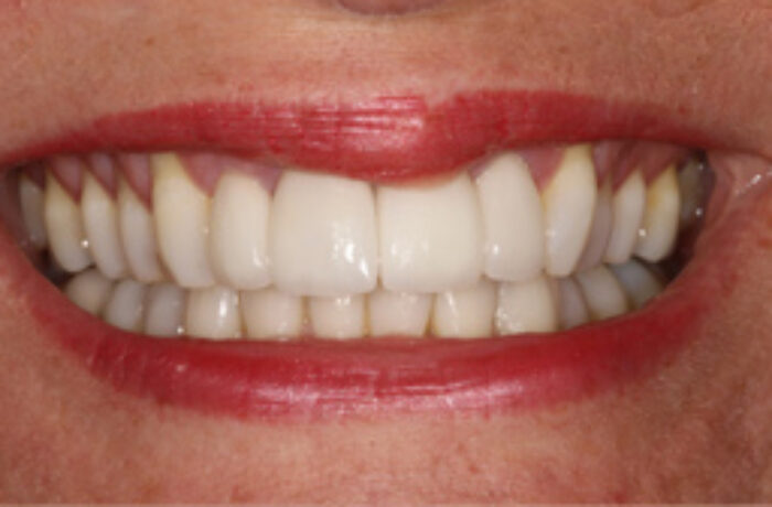 After - Cheadle Hulme Dental