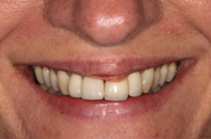 Before - Cheadle Hulme Dental