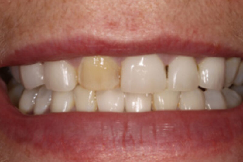 Before - Cheadle Hulme Dental