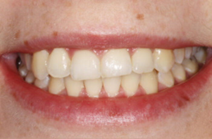 After - Cheadle Hulme Dental