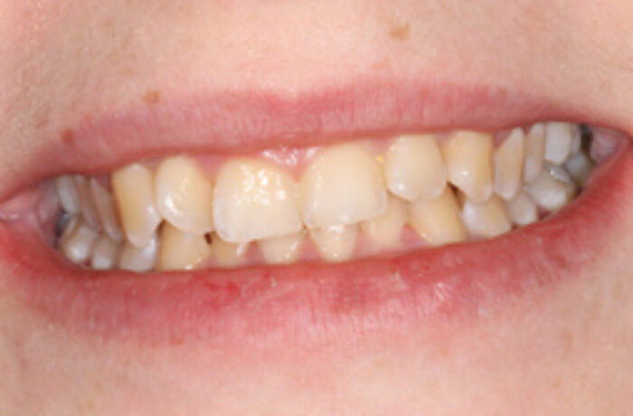 Before - Cheadle Hulme Dental