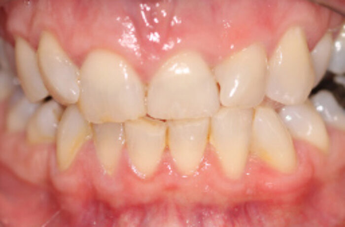 Before - Cheadle Hulme Dental