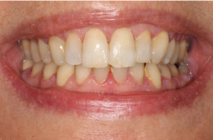 After - Cheadle Hulme Dental