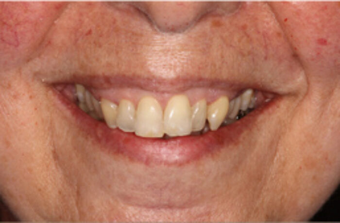Before - Cheadle Hulme Dental
