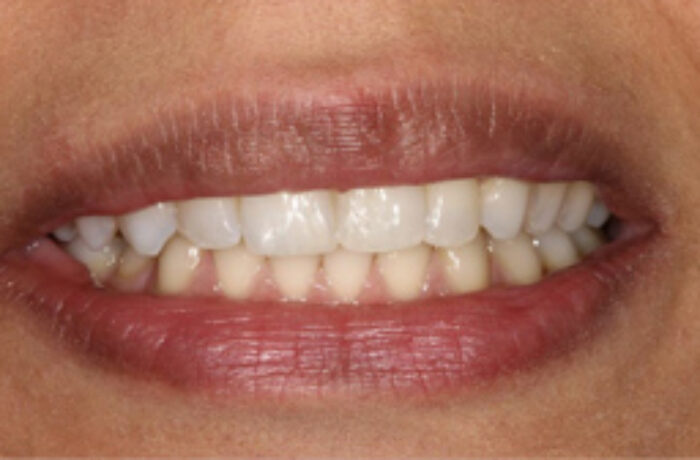 After - Cheadle Hulme Dental