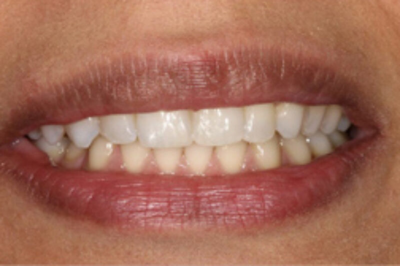 After - Cheadle Hulme Dental