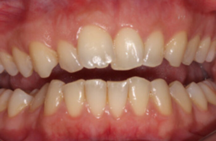 Before - Cheadle Hulme Dental