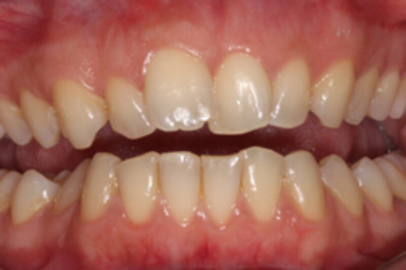 Before - Cheadle Hulme Dental