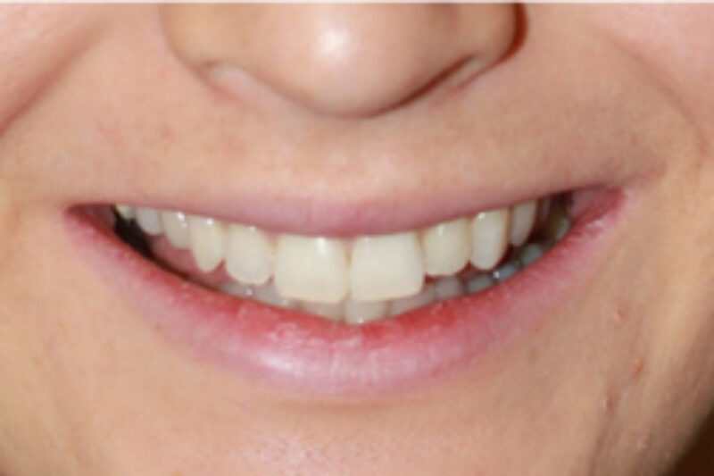 After - Cheadle Hulme Dental