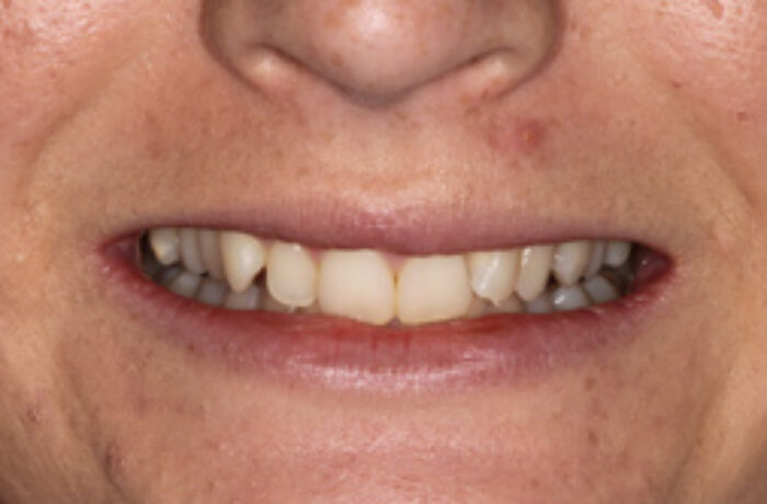 Before - Cheadle Hulme Dental