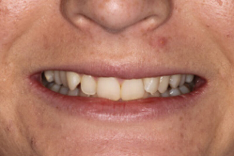 Before - Cheadle Hulme Dental