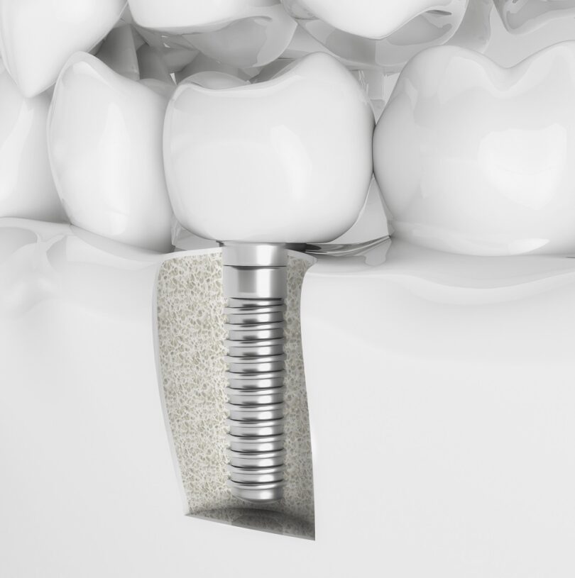 teeth health smile dentist