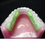 inman1-150x131