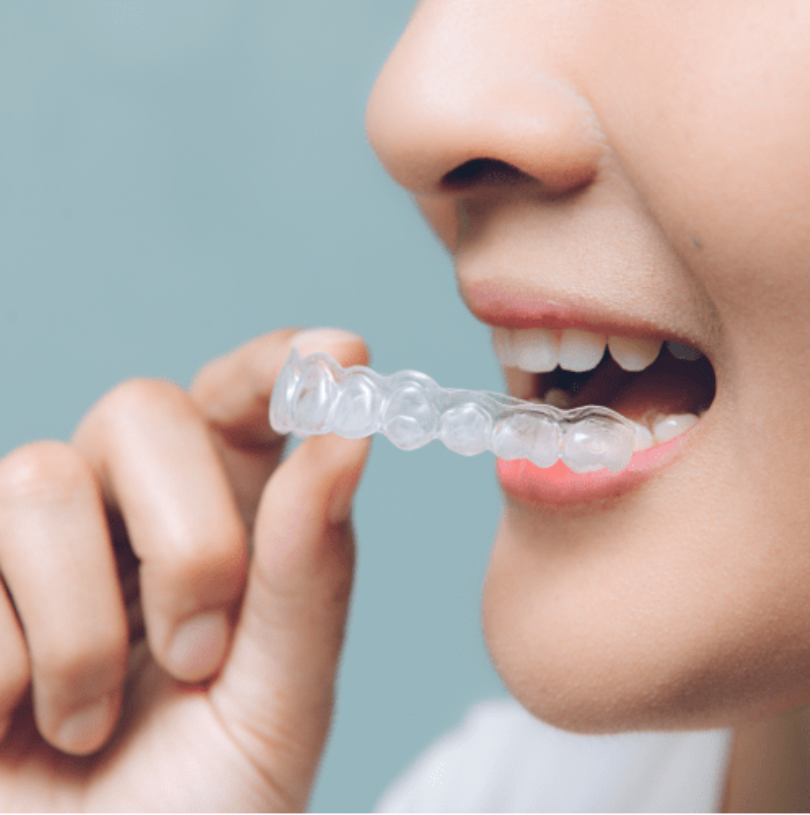 blog - Cheadle Hulme Dental