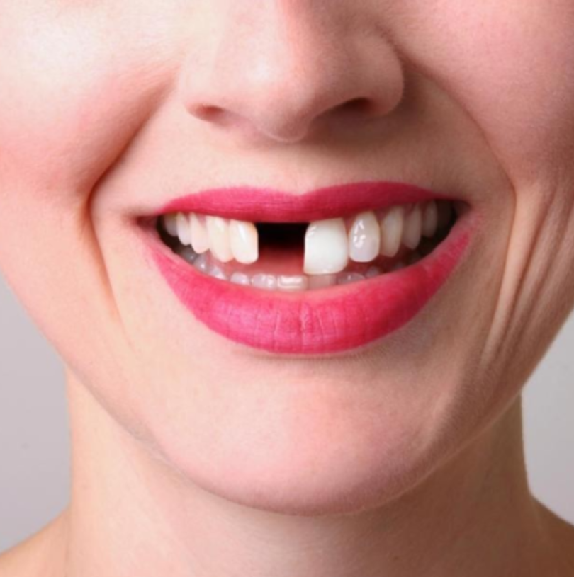 blog - Cheadle Hulme Dental