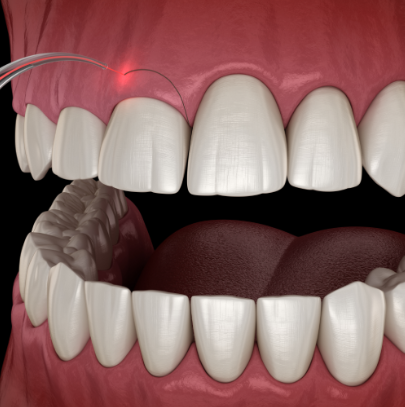 blog - Cheadle Hulme Dental