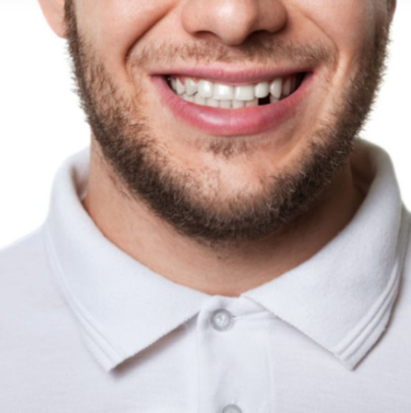 blog - Cheadle Hulme Dental