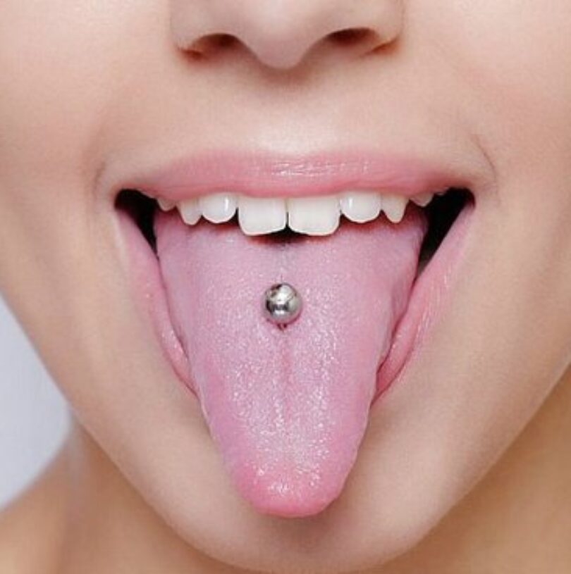 blog - Cheadle Hulme Dental