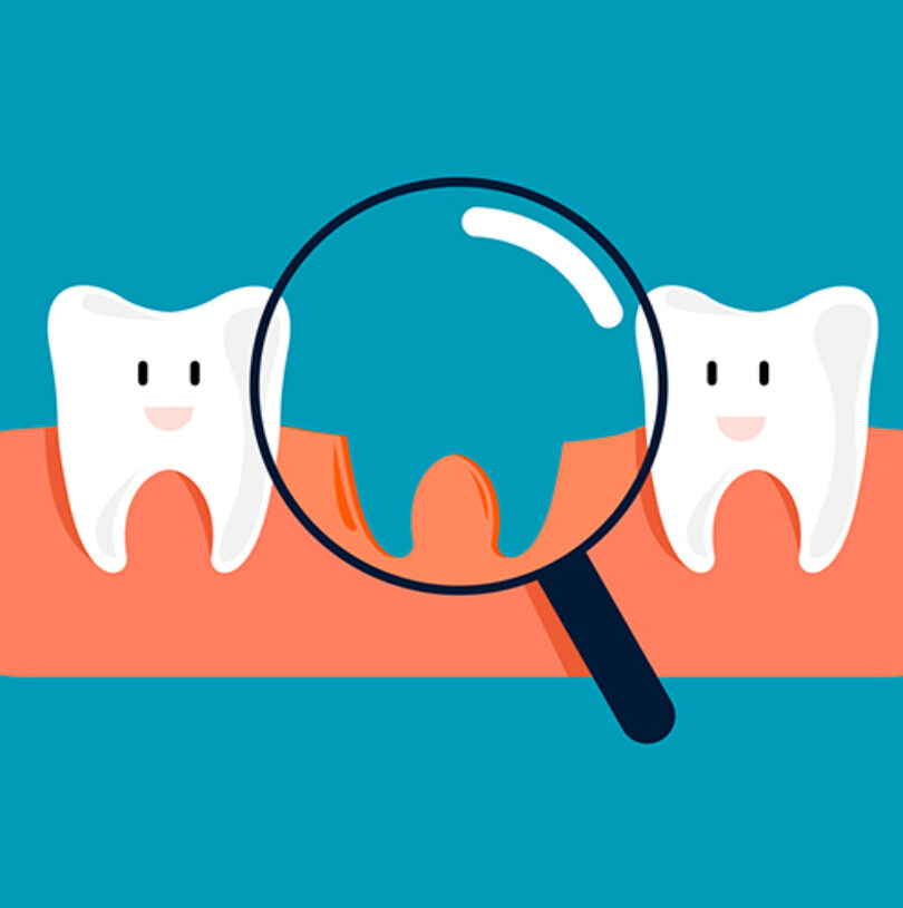 blog - Cheadle Hulme Dental