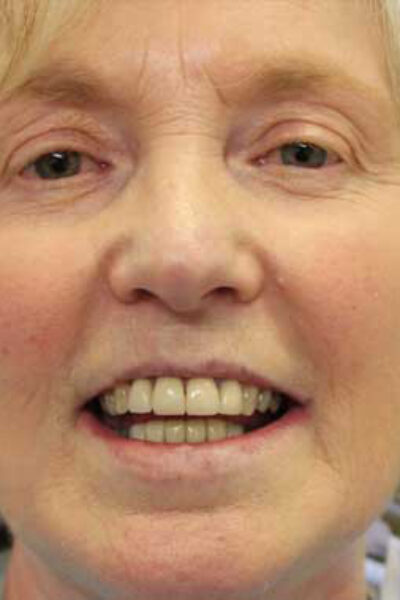 Cheadle Hulme Dental