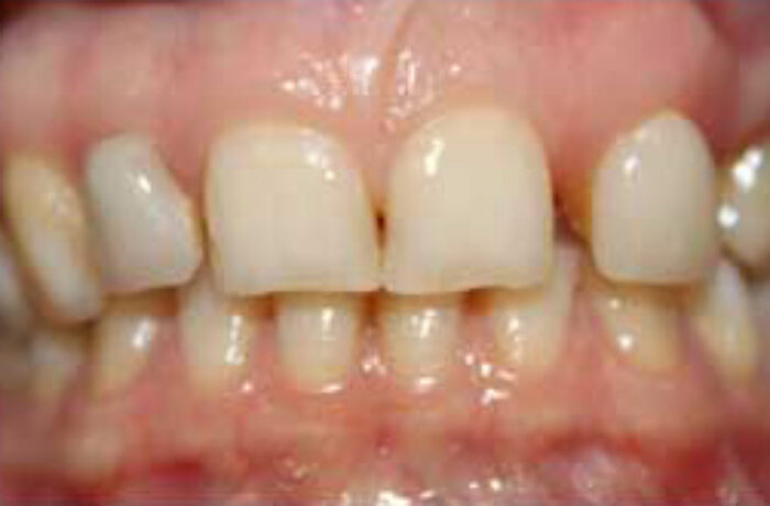 Before - Cheadle Hulme Dental