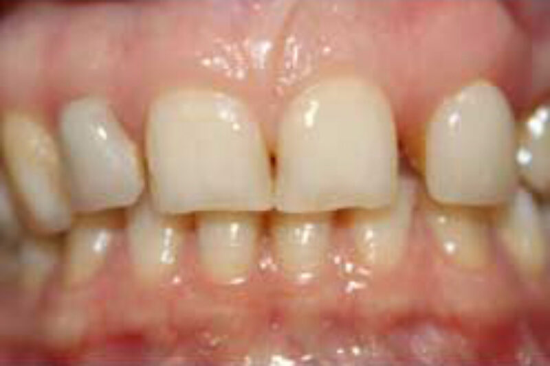 Before - Cheadle Hulme Dental