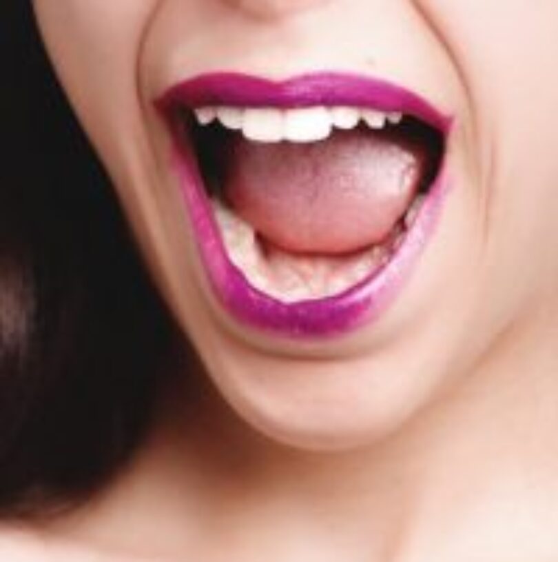 blog - Cheadle Hulme Dental