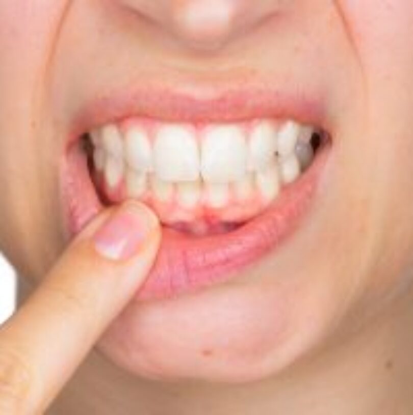 blog - Cheadle Hulme Dental