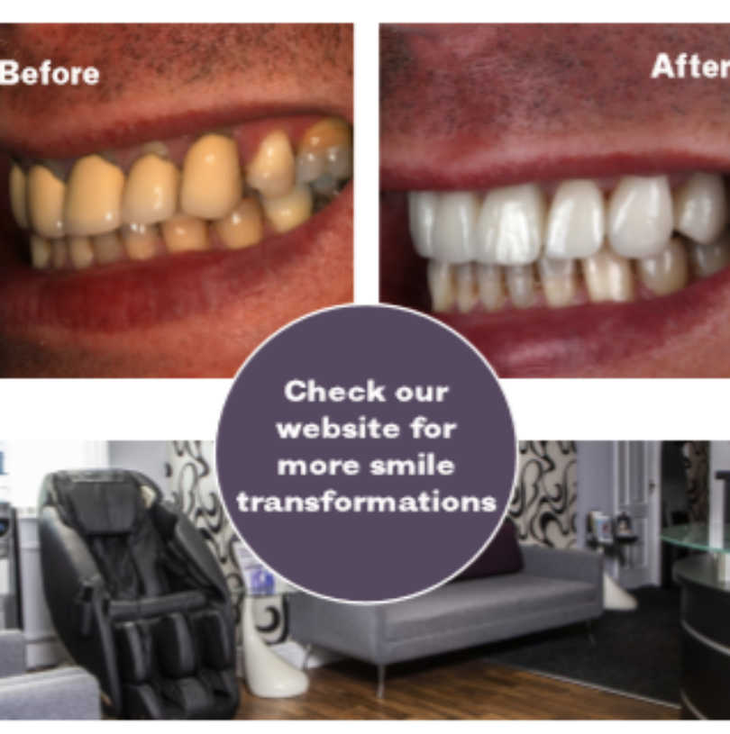 blog - Cheadle Hulme Dental