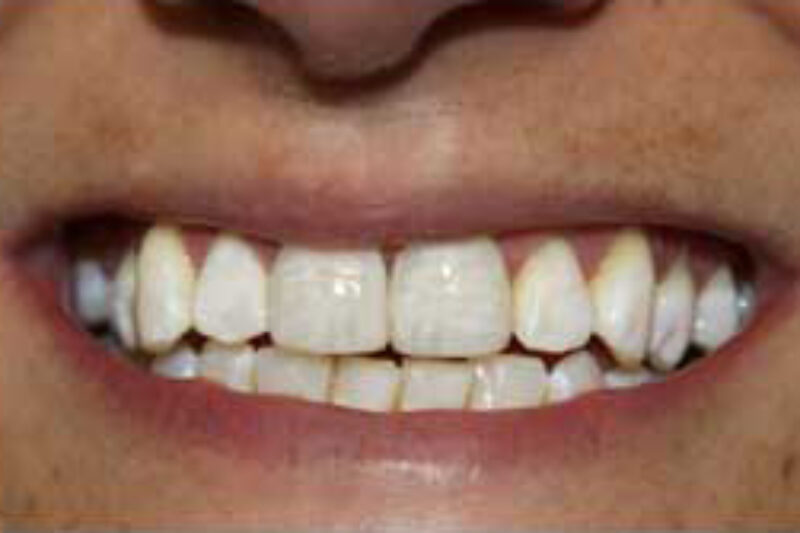 After - Cheadle Hulme Dental