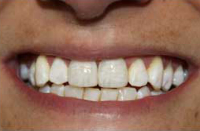 After - Cheadle Hulme Dental