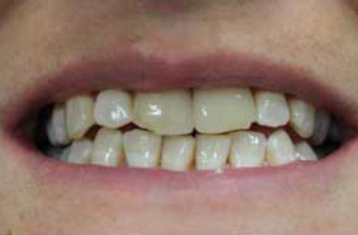 Before - Cheadle Hulme Dental