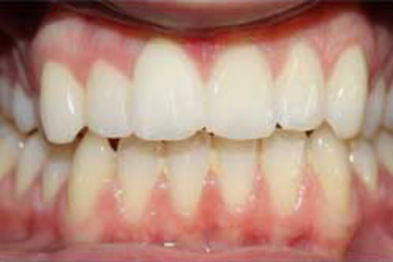 After - Cheadle Hulme Dental