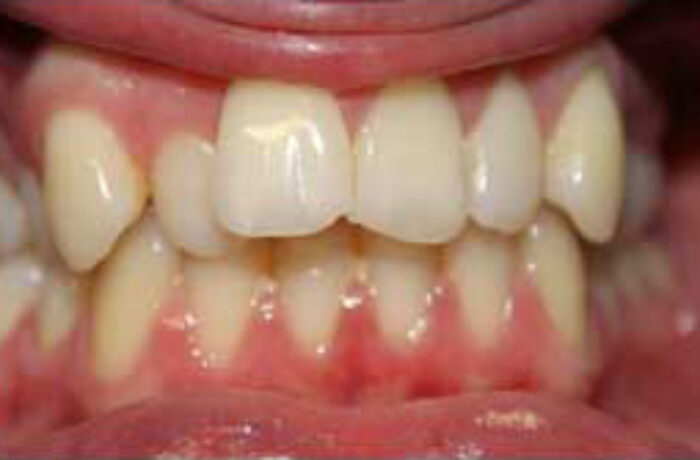 Before - Cheadle Hulme Dental