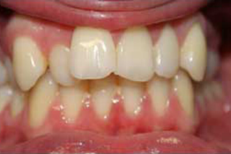 Before - Cheadle Hulme Dental