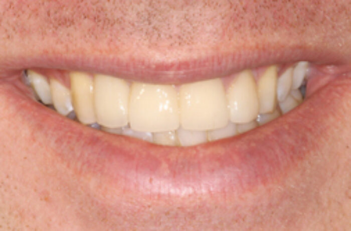 After - Cheadle Hulme Dental