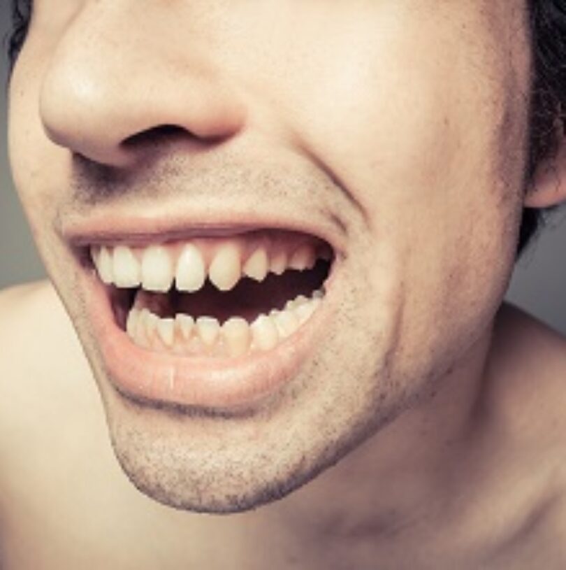 blog - Cheadle Hulme Dental