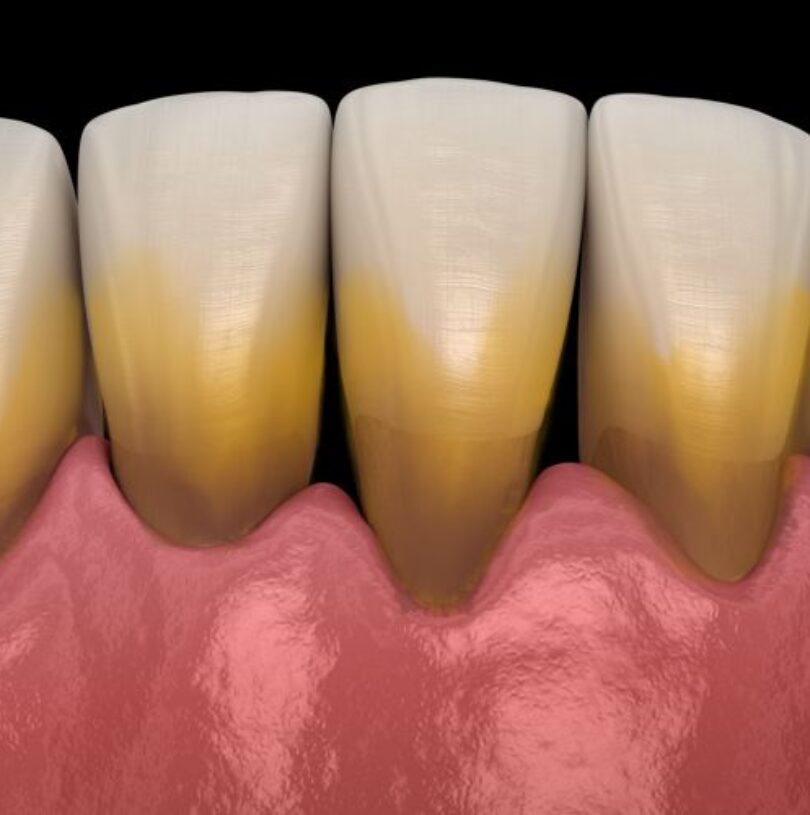 blog - Cheadle Hulme Dental