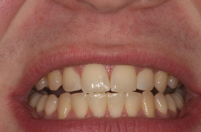 After - Cheadle Hulme Dental