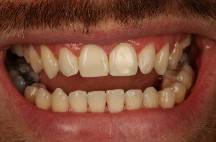 After - Cheadle Hulme Dental