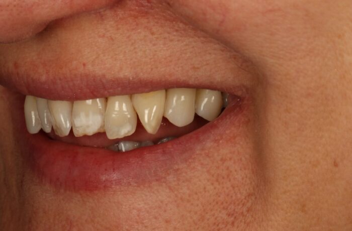 After - Cheadle Hulme Dental