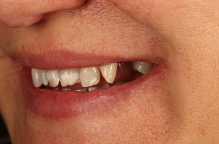 Before - Cheadle Hulme Dental