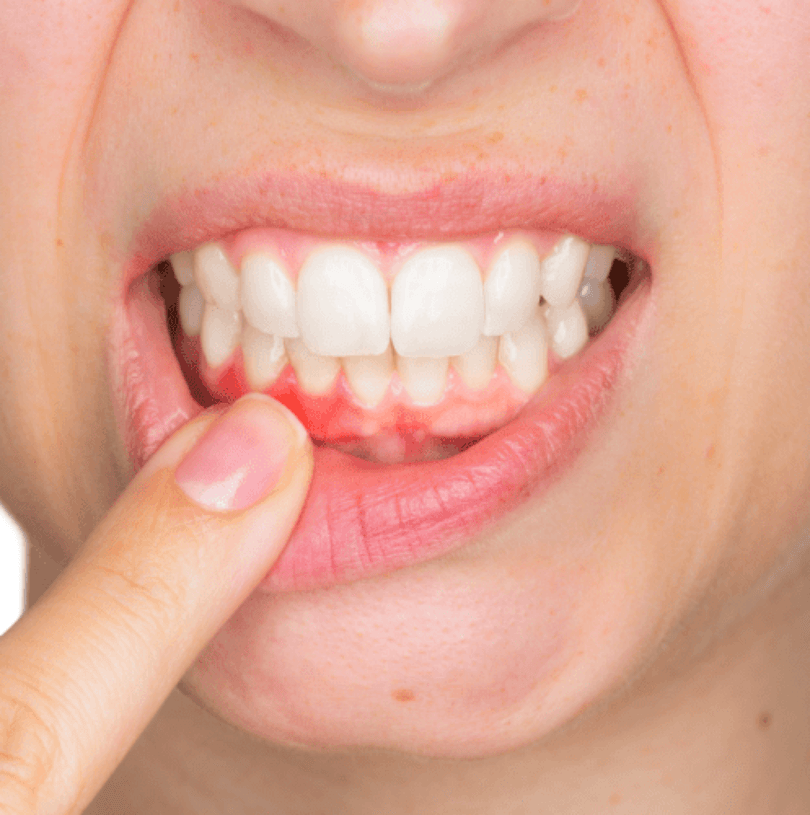 blog - Cheadle Hulme Dental
