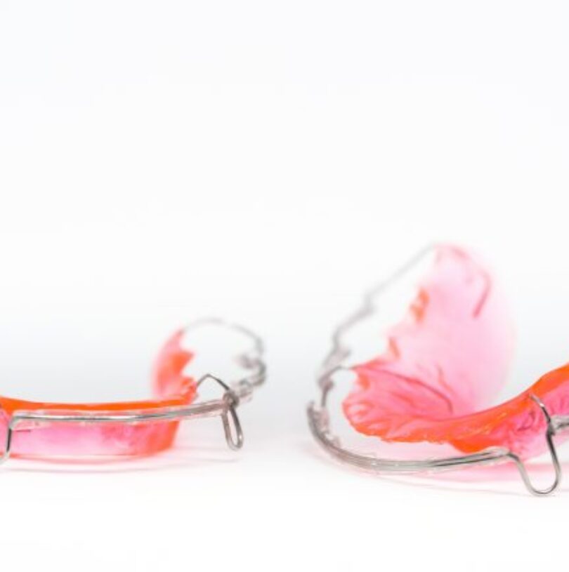 blog - Cheadle Hulme Dental