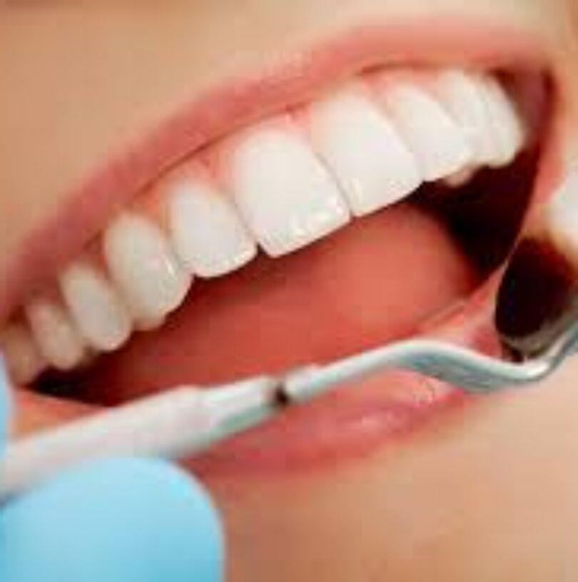 blog - Cheadle Hulme Dental