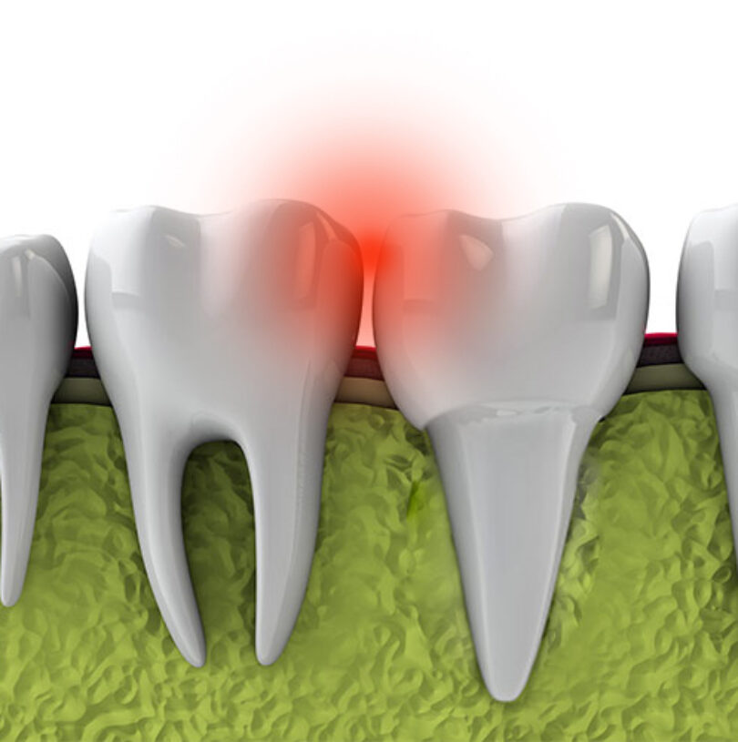 blog - Cheadle Hulme Dental