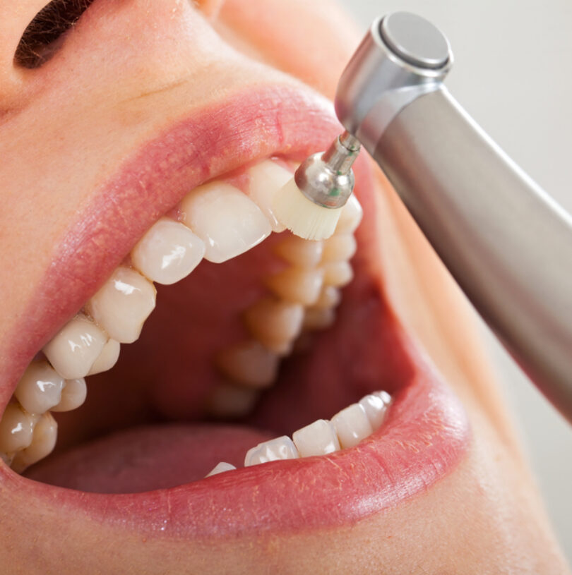 blog - Cheadle Hulme Dental