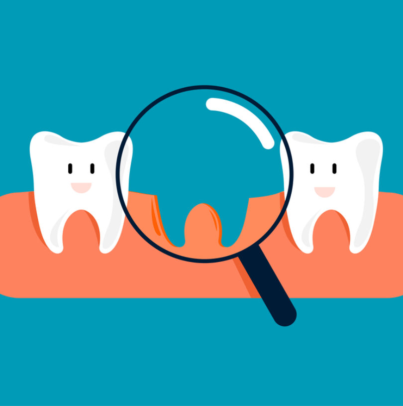 Dental Implants In Manchester