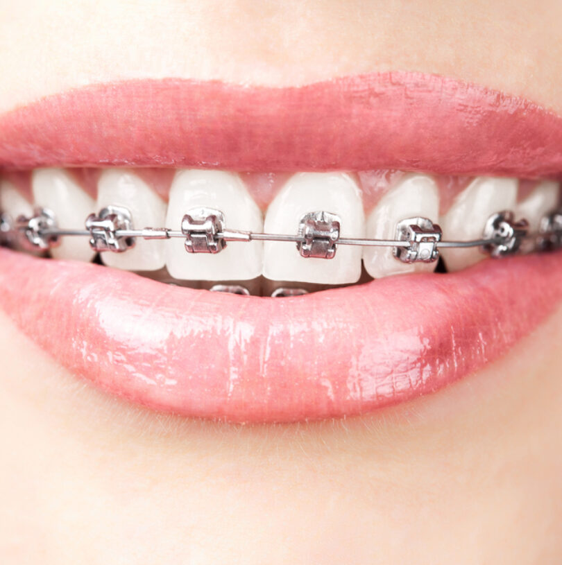 blog - Cheadle Hulme Dental